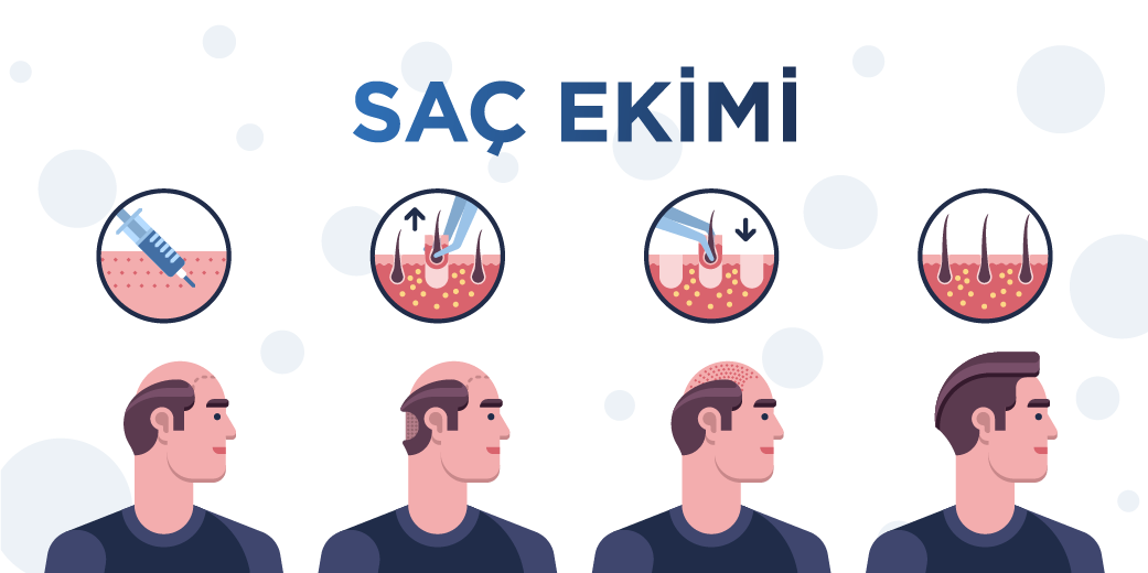 SAÇ EKİMİ - Antalya Hair Clinic